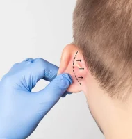 pegas medikal - flap-kulak estetiği